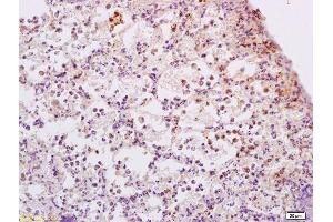 Formalin-fixed and paraffin embedded rat lung tissue labeled with Anti-ADCY9 Polyclonal Antibody, Unconjugated (ABIN751243) at 1:200 followed by conjugation to the secondary antibody and DAB staining