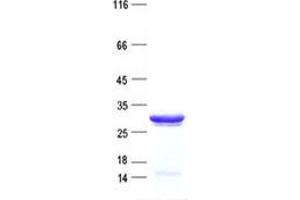 Validation with Western Blot (GSTT1 Protein (His tag))