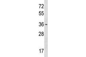 OTX1 antibody western blot analysis in T47D lysate. (OTX1 antibody  (AA 87-116))