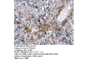 Rabbit Anti-ZNF365 Antibody  Paraffin Embedded Tissue: Human Liver Cellular Data: Hepatocyte Antibody Concentration: 4. (ZNF365 antibody  (N-Term))