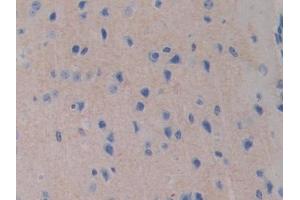 DAB staining on IHC-P; Samples: Mouse Cerebrum Tissue (FDFT1 antibody  (AA 217-416))