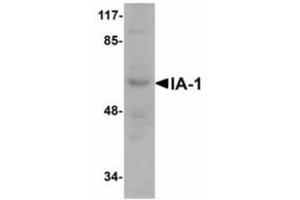 Image no. 1 for anti-Insulinoma-Associated 1 (INSM1) (N-Term) antibody (ABIN478172)