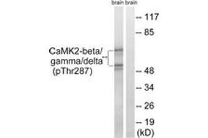 Western blot analysis of extracts from rat brain, using CaMK2-beta/gamma/delta (Phospho-Thr287) Antibody. (CaMK2 beta/gamma/delta (AA 253-302), (pThr287) antibody)