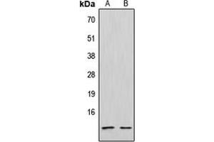 Western blot analysis of CXCL12 expression in Jurkat (A), NCIH292 (B) whole cell lysates. (CXCL12 antibody  (C-Term))
