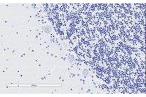 Image no. 2 for anti-Synaptosomal-Associated Protein, 25kDa (SNAP25) antibody (ABIN5894455) (SNAP25 antibody)