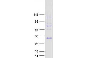 Validation with Western Blot (SPANXN3 Protein (Myc-DYKDDDDK Tag))