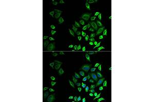 Immunofluorescence analysis of U2OS cells using PLG2D antibody (ABIN6132162, ABIN6145727, ABIN6145729 and ABIN6222983). (PLA2G2D antibody  (AA 21-145))