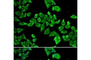 DDX20 antibody