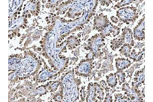 IHC analysis of Glutathione Reductase using anti-Glutathione Reductase antibody (ABIN5693151). (Glutathione Reductase antibody  (AA 256-522))