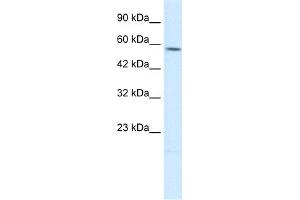 WB Suggested Anti-TPH2 Antibody Titration:  0. (Tryptophan Hydroxylase 2 antibody  (N-Term))