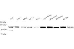 Western blot analysis of MTHFD1 (ABIN7074609) at dilution of 1: 1000