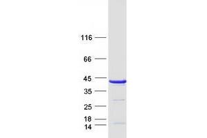 Validation with Western Blot (TBCC Protein (Myc-DYKDDDDK Tag))