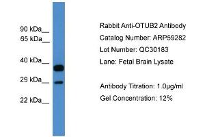 WB Suggested Anti-OTUB2  Antibody Titration: 0. (OTUB2 antibody  (Middle Region))