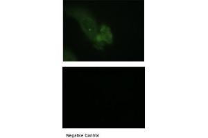 Immunohistochemistry (IHC) image for anti-Mucin 1 (MUC1) (C-Term) antibody (ABIN2776819)