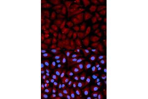 Immunofluorescence analysis of U2OS cells using SERPINC1 antibody. (SERPINC1 antibody  (AA 33-185))