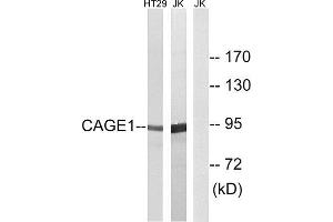 Western Blotting (WB) image for anti-Cancer Antigen 1 (CAGE1) (C-Term) antibody (ABIN1850982) (CAGE1 antibody  (C-Term))