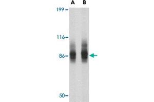 Western blot analysis of SP110 in SW480 cell lysate with SP110 polyclonal antibody  at (A) 1 and (B) 2 ug/mL .