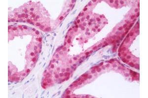 Anti-RARG / RAR-Gamma antibody IHC staining of human prostate. (Retinoic Acid Receptor gamma antibody  (AA 1-245))