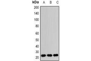 Western blot analysis of RAB24 expression in HeLa (A), RAW264. (RAB24 antibody)