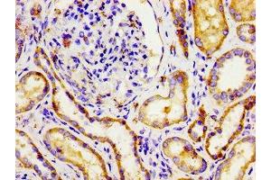 Immunohistochemistry of paraffin-embedded human kidney tissue using ABIN7145059 at dilution of 1:100 (NPR3 antibody  (AA 36-127))