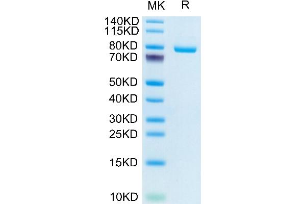 Transferrin Receptor Protein (His-Avi Tag)