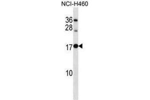 RPL12 Antibody (Center) western blot analysis in NCI-H460 cell line lysates (35µg/lane).