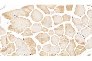 Detection of cTnI in Human Skeletal muscle Tissue using Monoclonal Antibody to Cardiac Troponin I (cTnI) (TNNI3 antibody  (AA 1-203))