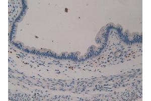 Detection of KL in Mouse Uterus Tissue using Polyclonal Antibody to Klotho (KL) (Klotho antibody  (AA 516-955))