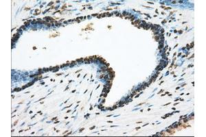 Immunohistochemical staining of paraffin-embedded Kidney tissue using anti-ACSBG1 mouse monoclonal antibody. (ACSBG1 antibody)
