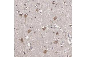 Immunohistochemical staining of human cerebral cortex with HECTD1 polyclonal antibody  shows moderate positivity in neurons at 1:50-1:200 dilution. (HECTD1 antibody)