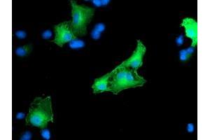 Anti-CCM2 mouse monoclonal antibody (ABIN2454943) immunofluorescent staining of COS7 cells transiently transfected by pCMV6-ENTRY CCM2 (RC201418). (CCM2 antibody)