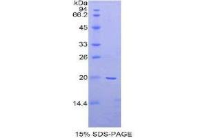 SDS-PAGE (SDS) image for Alpha2 Antiplasmin (SERPINF2) (AA 348-491) protein (His tag) (ABIN2120535)