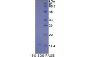 SDS-PAGE analysis of Mouse NAGase Protein. (MGEA5 Protein)