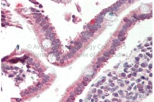 Immunohistochemistry (IHC) image for anti-SMAD Family Member 4 (SMAD4) (N-Term) antibody (ABIN2780673)