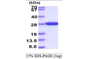 SDS-PAGE (SDS) image for Parkinson Protein 7 (PARK7) protein (His tag) (ABIN667043) (PARK7/DJ1 Protein (His tag))