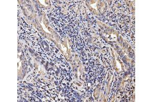 IHC analysis of EXOSC8 using anti-EXOSC8 antibody (ABIN7601850). (EXOSC8 antibody  (AA 49-216))