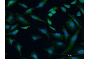 Immunofluorescence of monoclonal antibody to TRIP6 on HeLa cell. (TRIP6 antibody  (AA 1-100))