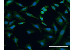 Immunofluorescence of monoclonal antibody to TRIP6 on HeLa cell.