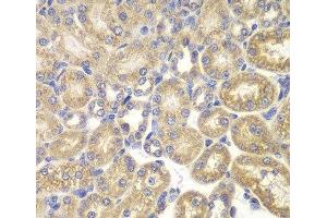 Immunohistochemistry of paraffin-embedded Rat kidney using PSMD9 Polyclonal Antibody at dilution of 1:200 (40x lens). (PSMD9 antibody)