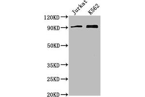 Western Blot Positive WB detected in: Jurkat whole cell lysate, K562 whole cell lysate All lanes: MARK2 antibody at 1:2000 Secondary Goat polyclonal to rabbit IgG at 1/50000 dilution Predicted band size: 88, 79, 84, 82, 81, 78, 87, 83, 80 kDa Observed band size: 88 kDa (MARK2 antibody  (AA 373-594))
