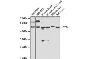 Western blot analysis of extracts of various cell lines, using SYT4 antibody (ABIN6129135, ABIN6148791, ABIN6148792 and ABIN6223676) at 1:1000 dilution. (SYT4 antibody  (AA 38-190))