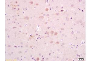 Formalin-fixed and paraffin rat brain tissue labeled with Anti-AKAP5 Polyclonal Antibody, Unconjugated (ABIN1387544) at 1:200, followed by conjugation to the secondary antibody and DAB staining (AKAP5 antibody  (AA 611-714))