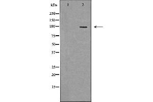 Western blot analysis of extracts of HeLa, using TLR5 antibody.