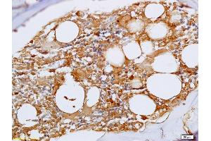 Formalin-fixed and paraffin embedded rat bone marrow labeled with Anti-Phospho-FLT3 (Tyr842) Polyclonal Antibody, Unconjugated (ABIN684868) at 1:200 followed by conjugation to the secondary antibody (FLT3 antibody  (pTyr842))