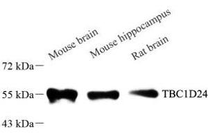 TBC1D24 antibody