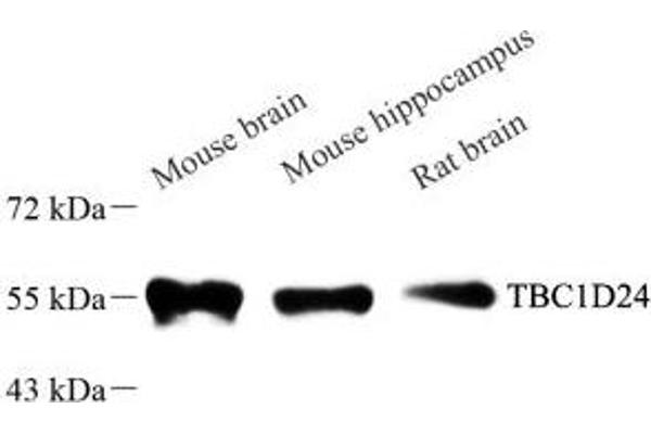 TBC1D24 antibody