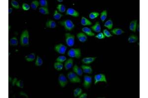 Immunofluorescence staining of Hela cells with ABIN7163832 at 1:200, counter-stained with DAPI. (PKD1 antibody  (AA 615-753))