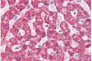 Human Liver (formalin-fixed, paraffin-embedded) stained with IFIH1 antibody ABIN337077 at 5 ug/ml followed by biotinylated goat anti-rabbit IgG secondary antibody ABIN481713, alkaline phosphatase-streptavidin and chromogen. (IFIH1 antibody  (Internal Region))