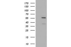 HEK293T cells were transfected with the pCMV6-ENTRY control (Left lane) or pCMV6-ENTRY DYNC1LI1 (Right lane) cDNA for 48 hrs and lysed. (DYNC1LI1 antibody)