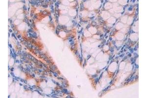 Detection of IAP in Mouse Colon Tissue using Polyclonal Antibody to Integrin Associated Protein (IAP) (CD47 antibody  (AA 18-219))